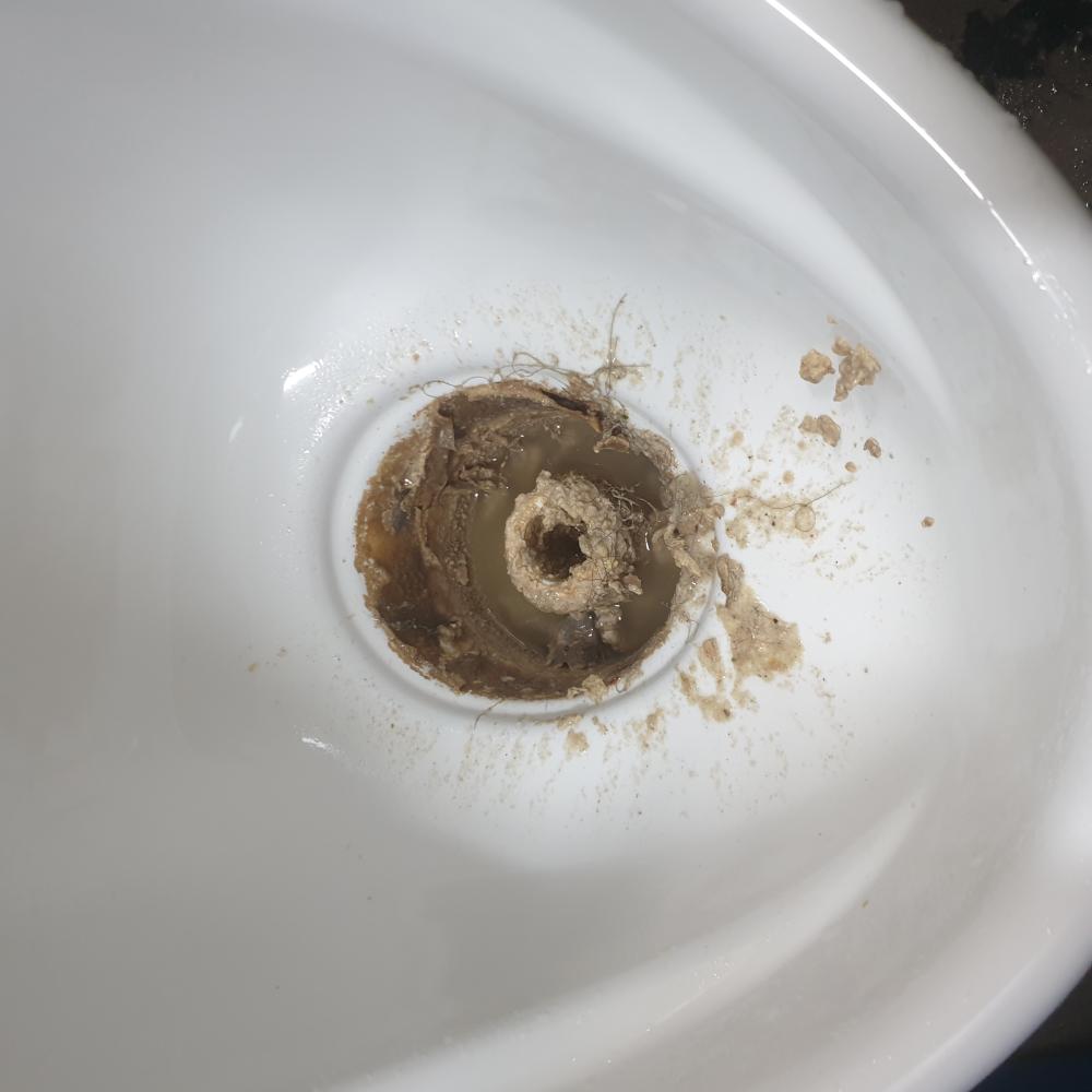 소변기 요석 제거